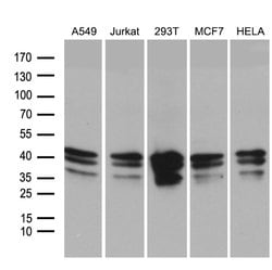 UPRT Monoclonal Antibody (OTI1D11), TrueMAB , OriGene:Antibodies:Primary