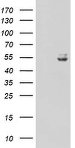 UQCRC1 Monoclonal Antibody (OTI1G2), TrueMAB , OriGene 100 &mu;L; Unconjugated:Antibodies,