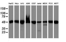 UQCRC1 Monoclonal Antibody (OTI1G2), TrueMAB , OriGene 100 &mu;L; Unconjugated:Antibodies,