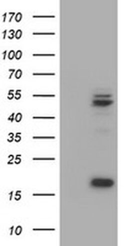 UQCRC1 Monoclonal Antibody (OTI1A3), TrueMAB , OriGene 100 &mu;L; Unconjugated:Antibodies,