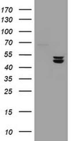 UQCRC1 Monoclonal Antibody (OTI2D10), TrueMAB , OriGene 100 &mu;L; Unconjugated:Antibodies,