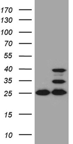 UQCRFS1 Mouse anti-Human, Mouse, Rat, Clone: OTI4H8, lyophilized, TrueMAB