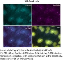 Usherin Rabbit anti-Human, Polyclonal, FabGennix 200 &mu;L; Unconjugated:Antibodies,