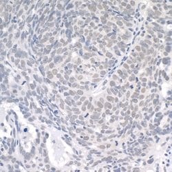 USP1 Polyclonal Antibody, Bethyl Laboratories 10 &mu;L; Unconjugated:Antibodies,