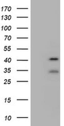 USP12 Monoclonal Antibody (OTI1E3), TrueMAB , OriGene 100 &mu;L; Unconjugated:Antibodies,