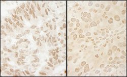 USP15 Rabbit anti-Human, Mouse, Rat, Polyclonal, Bethyl Laboratories 100