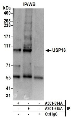 USP16 Rabbit anti-Human, Polyclonal, Bethyl Laboratories 100 &mu;L; Unconjugated:Antibodies,