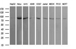 USP16 Monoclonal Antibody (OTI1B4), TrueMAB , OriGene 100 &mu;L; Unconjugated:Antibodies,