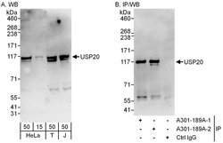 USP20/VDU2 Rabbit anti-Human, Mouse, Polyclonal, Bethyl Laboratories 100