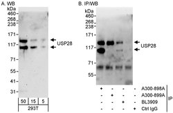 USP28 Rabbit anti-Human, Polyclonal, Bethyl Laboratories 100 &mu;L; Unconjugated:Antibodies,