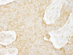 USP3 Polyclonal Antibody, Bethyl Laboratories 100 &mu;L; Unconjugated:Antibodies,