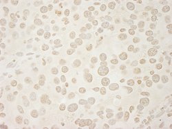 USP33 Polyclonal Antibody, Bethyl Laboratories 10 &mu;L; Unconjugated:Antibodies,