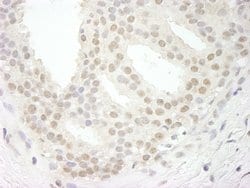 USP34 Polyclonal Antibody, Bethyl Laboratories:Antibodies:Primary Antibodies