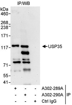 USP35 Rabbit anti-Human, Polyclonal, Bethyl Laboratories 10 &mu;L; Unconjugated:Antibodies,