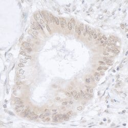 USP36/DUB1 Rabbit anti-Human, Polyclonal, Bethyl Laboratories 100 &mu;l;