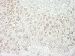 USP37 Rabbit anti-Human, Polyclonal, Bethyl Laboratories 10 &mu;L; Unconjugated:Antibodies,