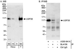 USP38 Rabbit anti-Human, Polyclonal, Bethyl Laboratories 100 &mu;L; Unconjugated:Antibodies,