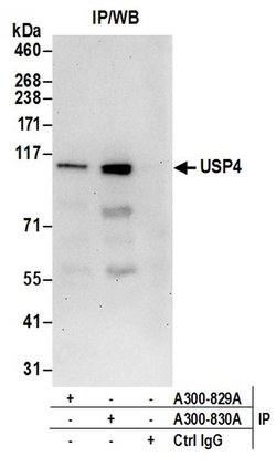 USP4 Rabbit anti-Human, Polyclonal, Bethyl Laboratories 100 &mu;L; Unconjugated:Antibodies,