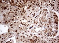 USP44 Mouse anti-Human, Clone: OTI1A9, lyophilized, TrueMAB 100 &mu;g;