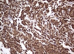 USP44 Mouse anti-Human, Clone: OTI1A9, lyophilized, TrueMAB 100 &mu;g;