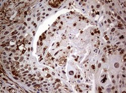 USP44 Monoclonal Antibody (OTI1F9), TrueMAB , OriGene 100 &mu;L; Unconjugated:Antibodies,