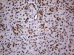 USP44 Monoclonal Antibody (OTI1F9), TrueMAB , OriGene 100 &mu;L; Unconjugated:Antibodies,