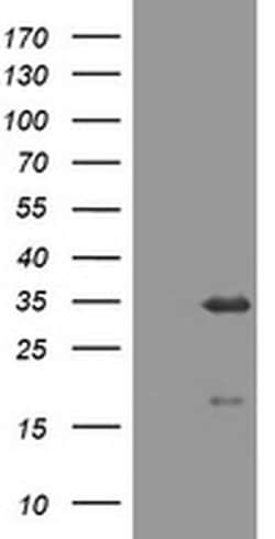 USP44 Monoclonal Antibody (OTI4E8), TrueMAB , OriGene 100 &mu;L; Unconjugated:Antibodies,