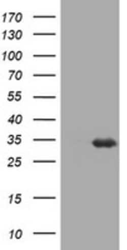 USP44 Mouse anti-Human, Clone: OTI1A9, lyophilized, TrueMAB 100 &mu;g;