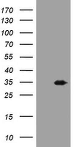 USP44 Monoclonal Antibody (OTI1F9), TrueMAB , OriGene 100 &mu;L; Unconjugated:Antibodies,