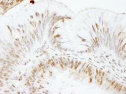 USP47 Rabbit anti-Human, Polyclonal, Bethyl Laboratories 100 &mu;L; Unconjugated:Antibodies,