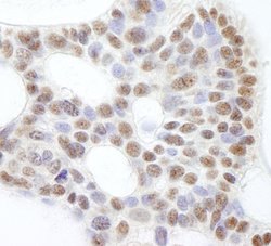 USP47 Polyclonal Antibody, Bethyl Laboratories:Antibodies:Primary Antibodies