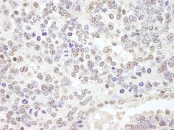 USP47 Polyclonal Antibody, Bethyl Laboratories 100 &mu;L; Unconjugated:Antibodies,