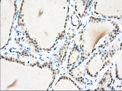 USP5 Monoclonal Antibody (OTI1F8), TrueMAB , OriGene 100 &mu;L; Unconjugated:Antibodies,