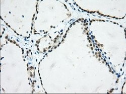 USP5 Monoclonal Antibody (OTI2F5), TrueMAB , OriGene 30 &mu;L; Unconjugated:Antibodies,