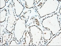 USP5 Monoclonal Antibody (OTI2E3), TrueMAB , OriGene 30 &mu;L; Unconjugated:Antibodies,