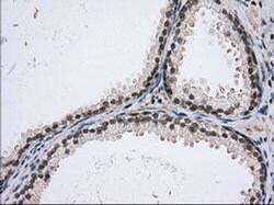 USP5 Monoclonal Antibody (OTI1A8), TrueMAB , OriGene 100 &mu;L; Unconjugated:Antibodies,