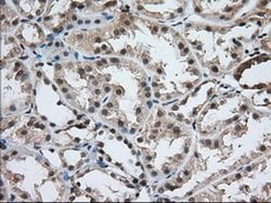 USP5 Monoclonal Antibody (OTI1A8), TrueMAB , OriGene 100 &mu;L; Unconjugated:Antibodies,