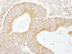 USP5/IsoT Polyclonal Antibody, Bethyl Laboratories 10 μL; Unconjugated:Antibodies,