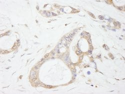 USP5/IsoT Polyclonal Antibody, Bethyl Laboratories 10 μL; Unconjugated:Antibodies,