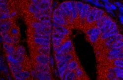 USP5/IsoT Polyclonal Antibody, Bethyl Laboratories 10 μL; Unconjugated:Antibodies,
