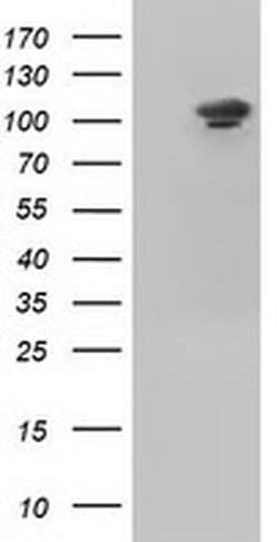 USP5 Monoclonal Antibody (OTI2E3), TrueMAB , OriGene 30 &mu;L; Unconjugated:Antibodies,