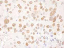 USP7 Goat anti-Human, Mouse, Polyclonal, Bethyl Laboratories 100 &mu;L;