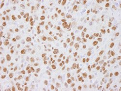 USP7 Polyclonal Antibody, Bethyl Laboratories 10 &mu;L; Unconjugated:Antibodies,
