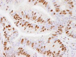USP7 Polyclonal Antibody, Bethyl Laboratories:Antibodies:Primary Antibodies