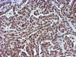 USP7 Mouse anti-Human, Clone: OTI1F12, lyophilized, TrueMAB 100 &mu;g;