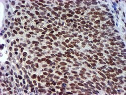 USP7 Mouse anti-Human, Clone: OTI1F12, lyophilized, TrueMAB 100 &mu;g;