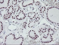 USP7 Monoclonal Antibody (OTI3D3), TrueMAB , OriGene 30 &mu;L; Unconjugated:Antibodies,