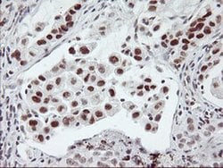 USP7 Monoclonal Antibody (OTI3C1), TrueMAB , OriGene 100 &mu;L; Unconjugated:Antibodies,