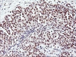 USP7 Monoclonal Antibody (OTI3C1), TrueMAB , OriGene 100 &mu;L; Unconjugated:Antibodies,