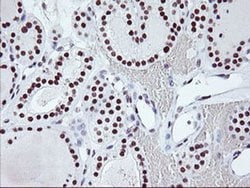 USP7 Monoclonal Antibody (OTI3C1), TrueMAB , OriGene 100 &mu;L; Unconjugated:Antibodies,